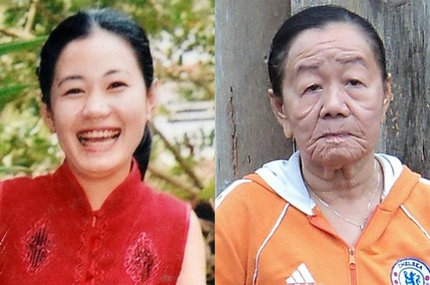 26岁美貌女一夜衰老成90岁老太